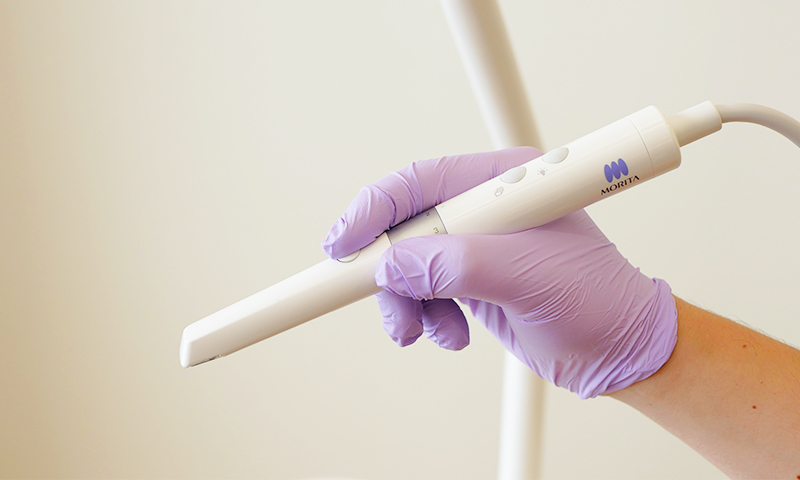 口腔内カメラ（ペンタイプ）