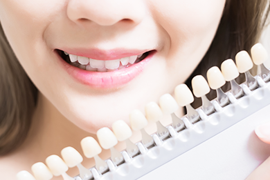 ホワイトニング